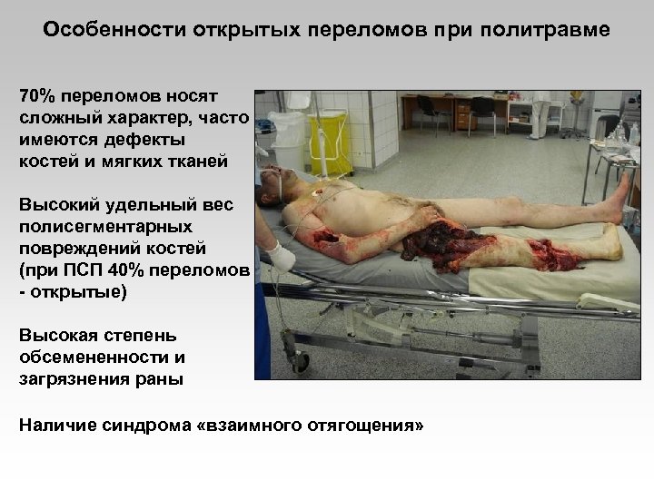 Особенности открытых переломов при политравме 70% переломов носят сложный характер, часто имеются дефекты костей