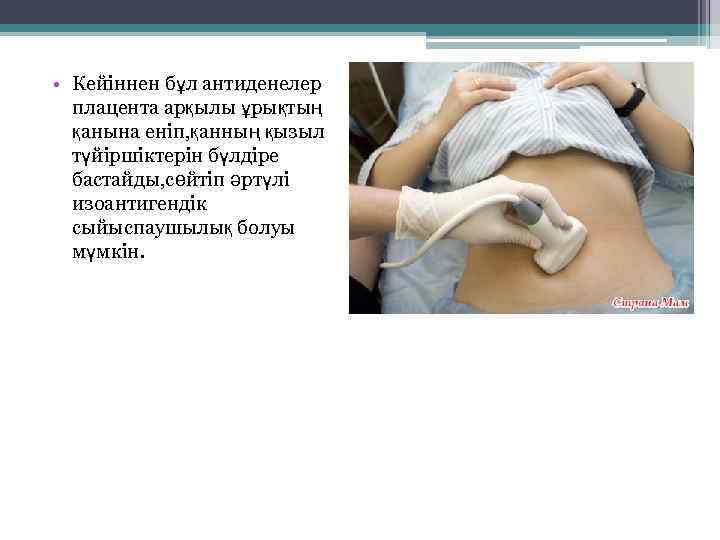  • Кейіннен бұл антиденелер плацента арқылы ұрықтың қанына еніп, қанның қызыл түйіршіктерін бүлдіре
