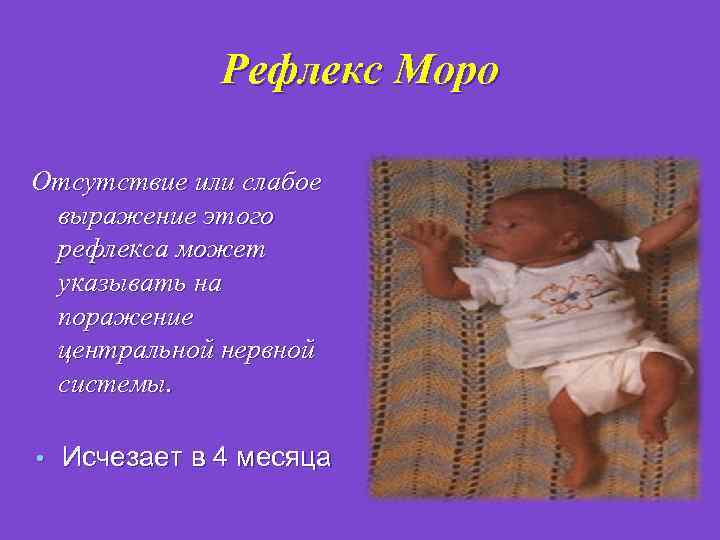 Рефлекс моро фото