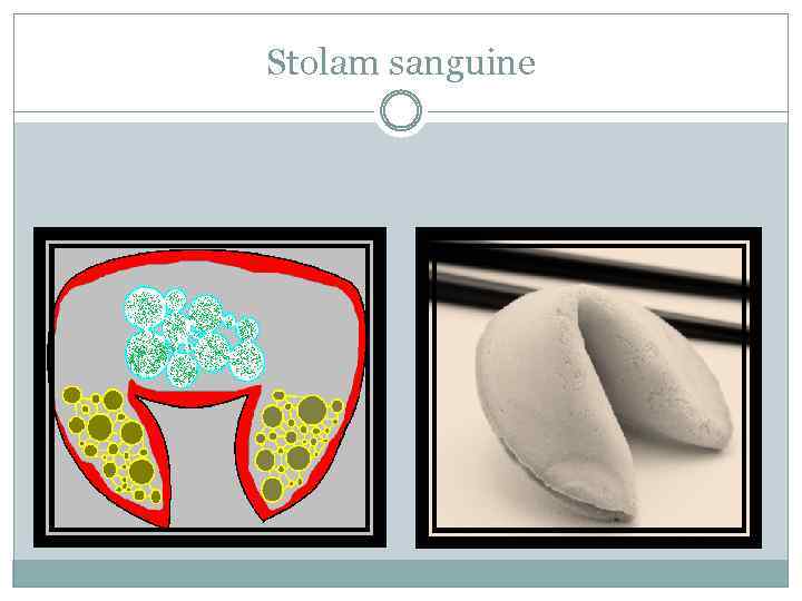 Stolam sanguine 