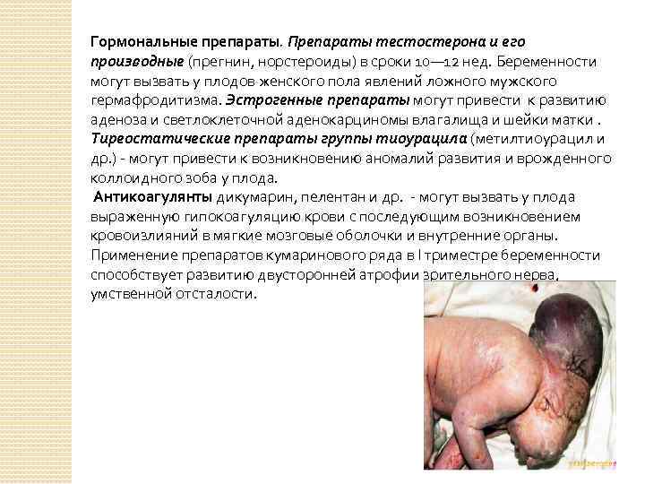 Гормональные препараты. Препараты тестостерона и его производные (прегнин, норстероиды) в сроки 10— 12 нед.