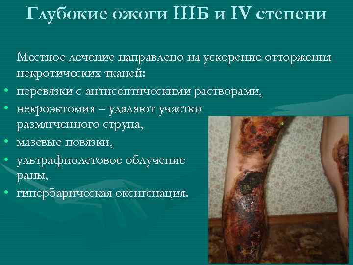 Глубокие ожоги IIIБ и IV степени • • • Местное лечение направлено на ускорение