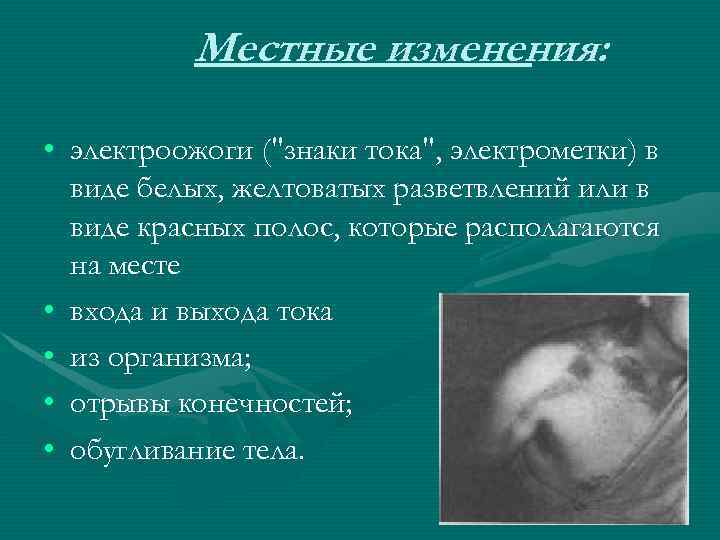 Местные изменения: • электроожоги (