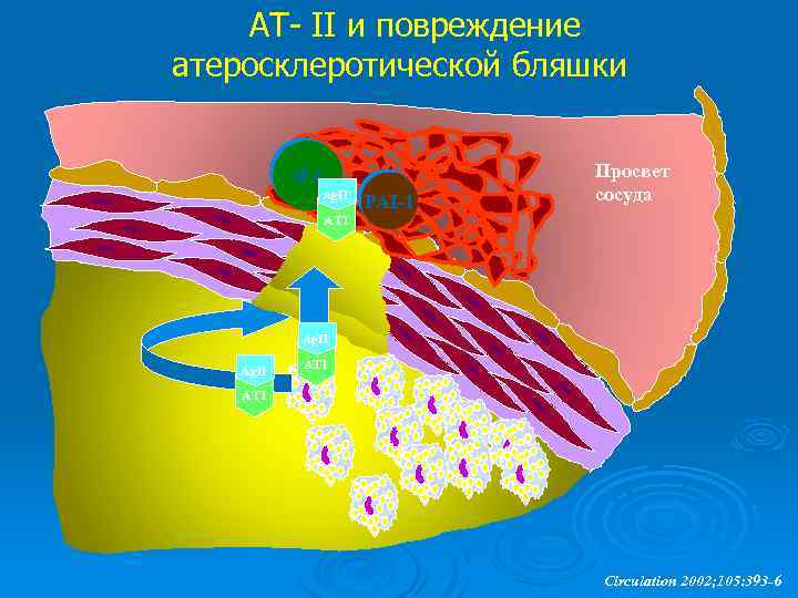 АТ- II и повреждение атеросклеротической бляшки t. PA Ag. II PAI-1 Просвет сосуда AT