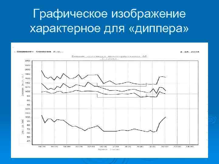 Графическое изображение характерное для «диппера» 