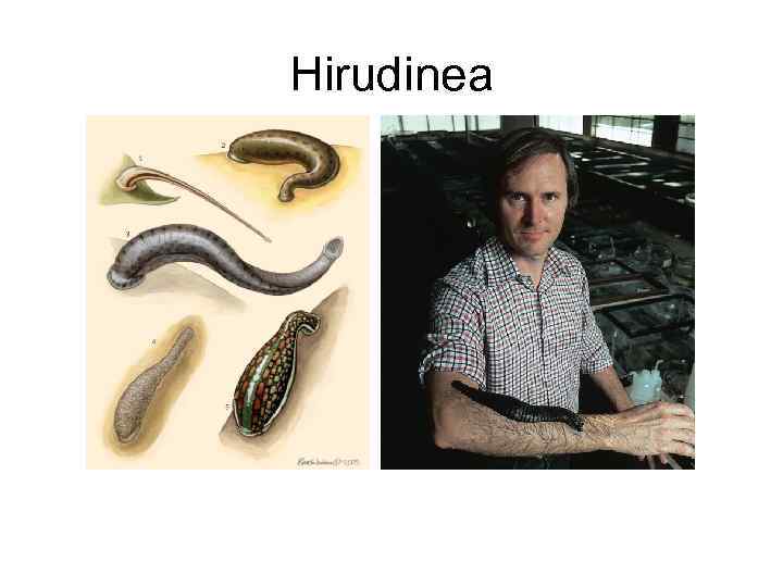 Hirudinea 