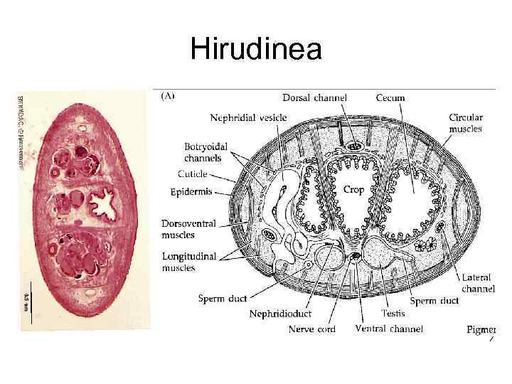 Hirudinea 