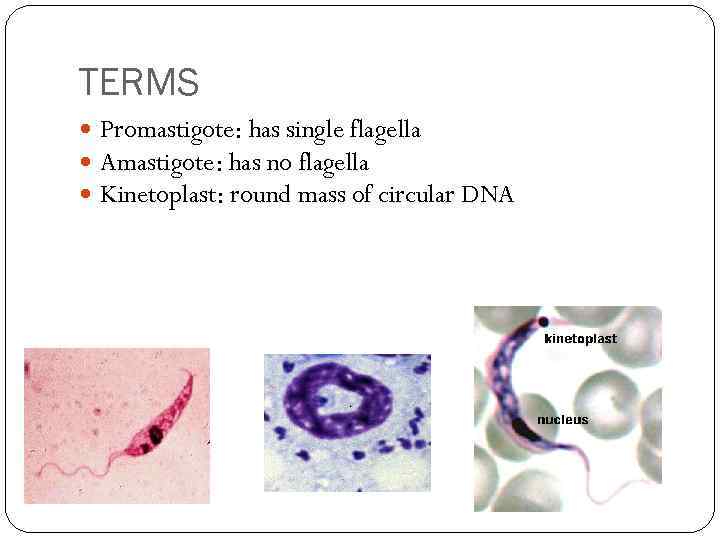 TERMS Promastigote: has single flagella Amastigote: has no flagella Kinetoplast: round mass of circular