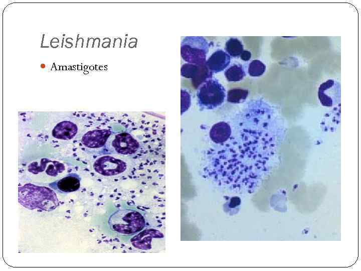 Leishmania Amastigotes 