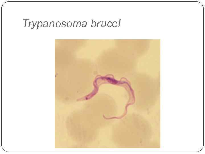 Trypanosoma brucei 