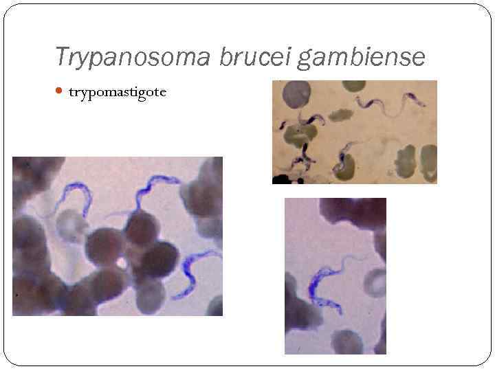 Trypanosoma brucei gambiense trypomastigote 