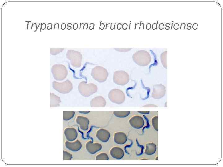 Trypanosoma brucei rhodesiense 