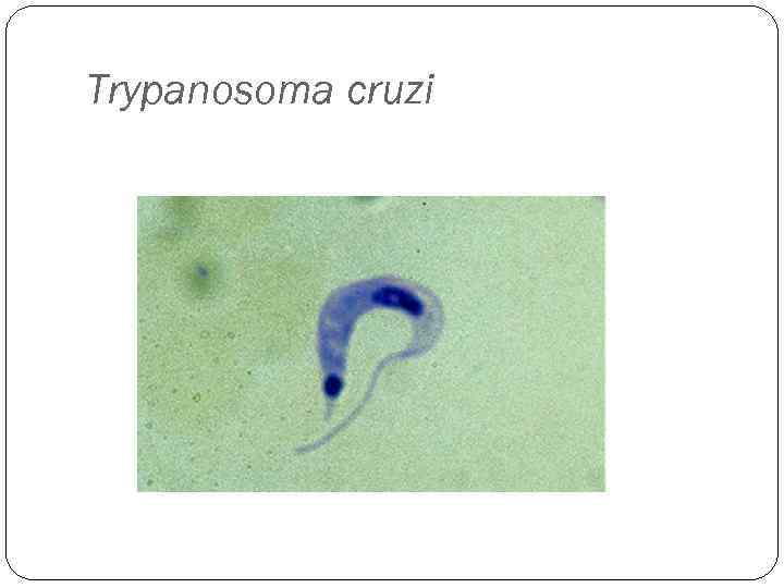 Trypanosoma cruzi 