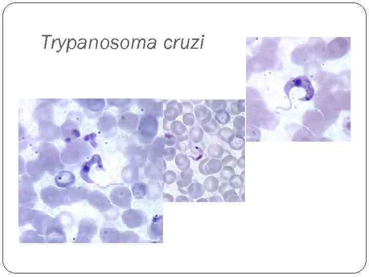 Trypanosoma cruzi 