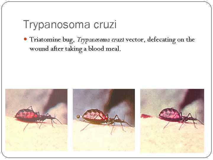 Trypanosoma cruzi Triatomine bug, Trypanosoma cruzi vector, defecating on the wound after taking a