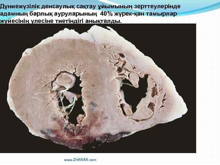 Дүниежүзілік денсаулық сақтау ұйымының зерттеулерінде адамның барлық ауруларының 40% жүрек-қан тамырлар жүйесінің үлесіне тиетіндігі