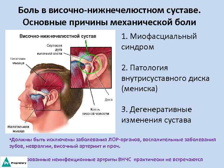 Боль в височно-нижнечелюстном суставе. Основные причины механической боли 1. Миофасциальный синдром 2. Патология внутрисуставного