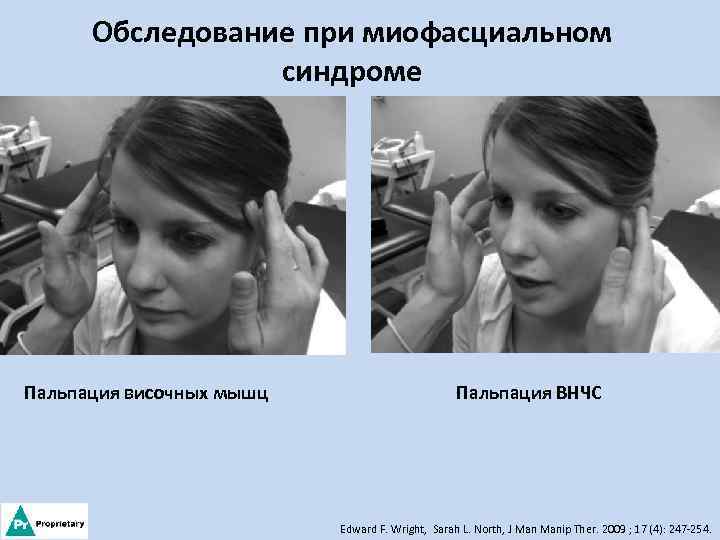 Обследование при миофасциальном синдроме Пальпация височных мышц Пальпация ВНЧС Edward F. Wright, Sarah L.