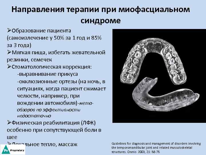 Направления терапии при миофасциальном синдроме ØОбразование пациента (самоизлечение у 50% за 1 год и