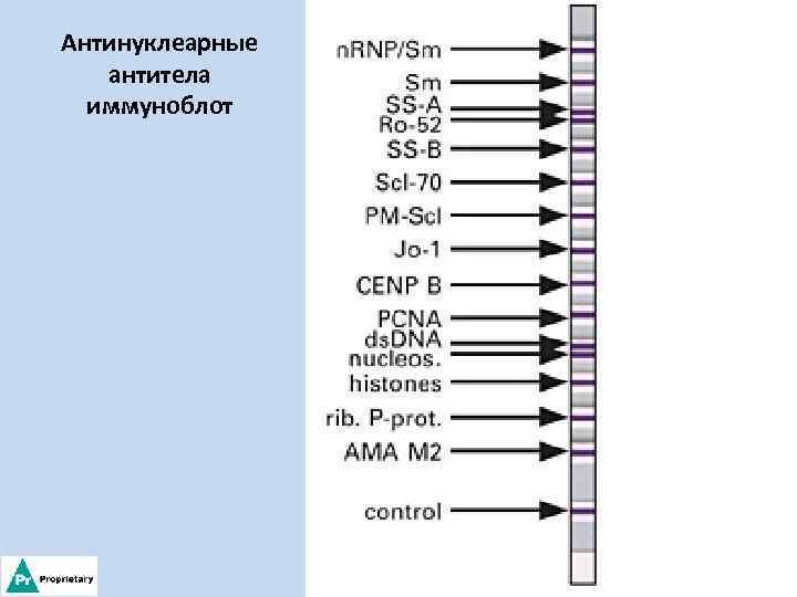 Антинуклеарные антитела иммуноблот 