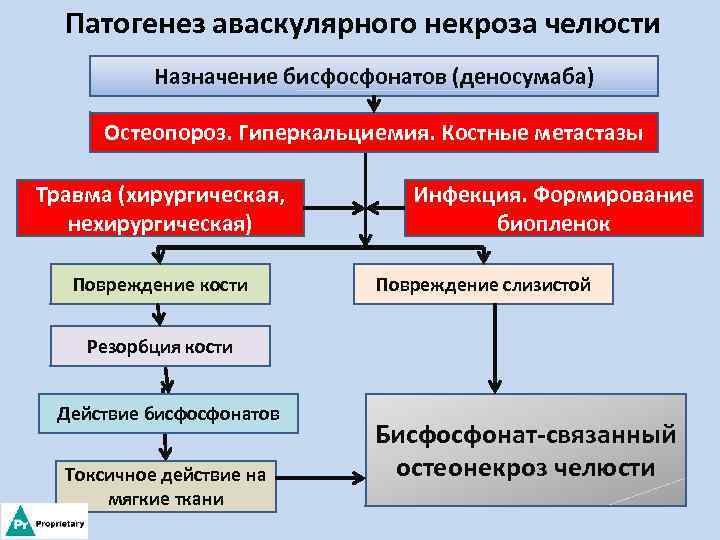 Патогенез аваскулярного некроза челюсти Назначение бисфосфонатов (деносумаба) Остеопороз. Гиперкальциемия. Костные метастазы Травма (хирургическая, нехирургическая)
