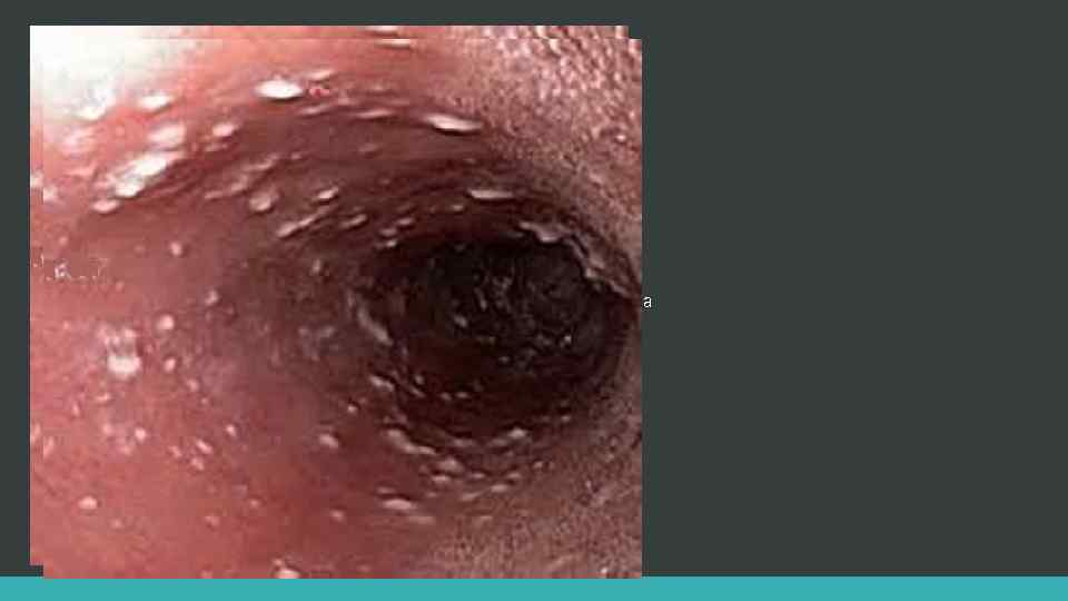 дерматитами наружного уха 