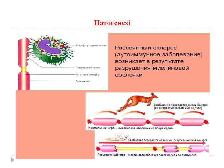 Патогенезі 