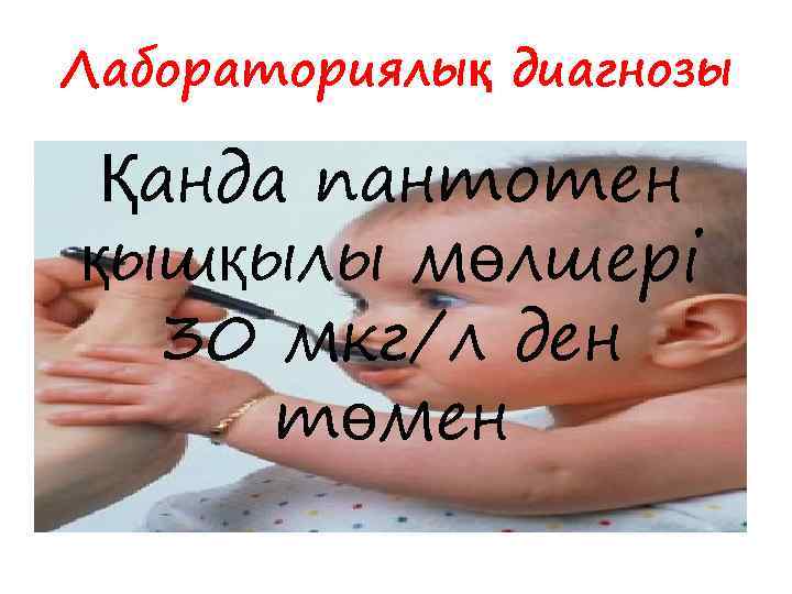 Лабораториялық диагнозы Қанда пантотен қышқылы мөлшері 30 мкг/л ден төмен 