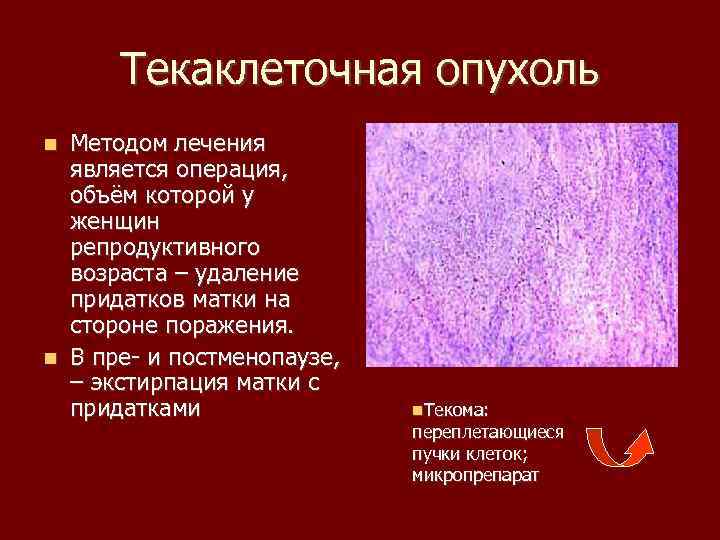 Текаклеточная опухоль Методом лечения является операция, объём которой у женщин репродуктивного возраста – удаление