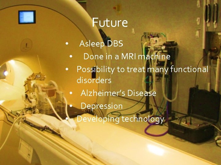 Future • • • Asleep DBS Done in a MRI machine Possibility to treat