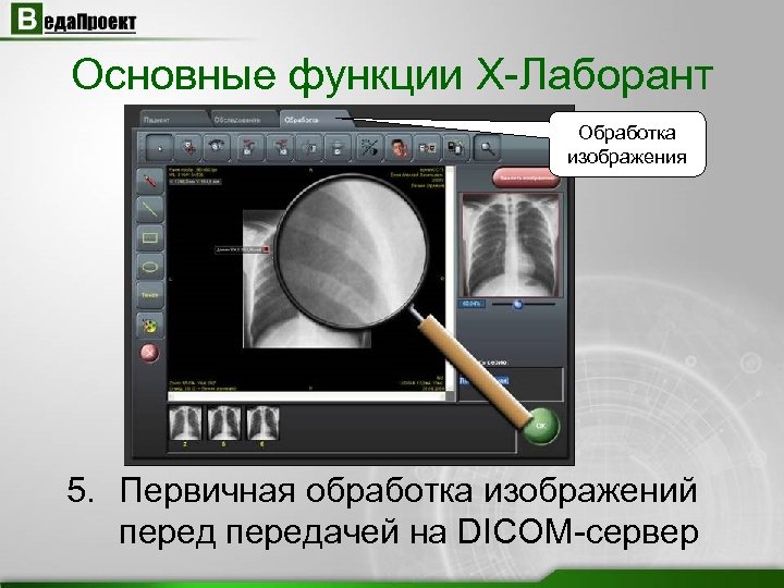 Основные функции X-Лаборант Обработка изображения 5. Первичная обработка изображений передачей на DICOM-сервер 
