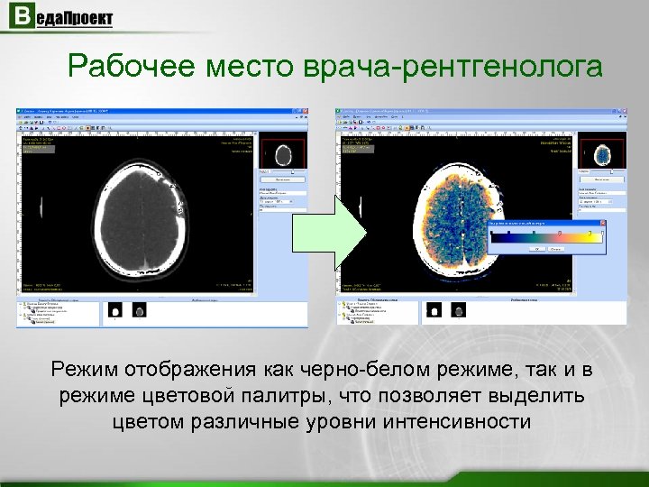 Рабочее место врача-рентгенолога Режим отображения как черно-белом режиме, так и в режиме цветовой палитры,