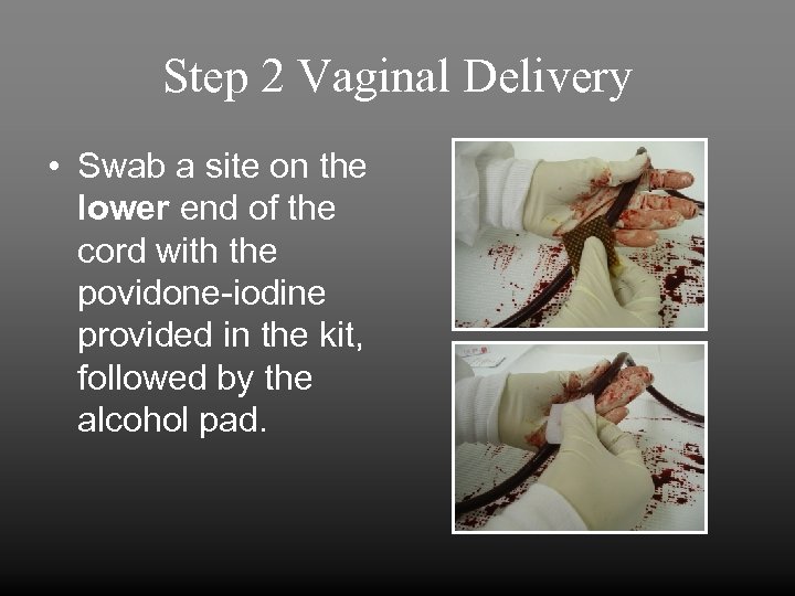 Step 2 Vaginal Delivery • Swab a site on the lower end of the