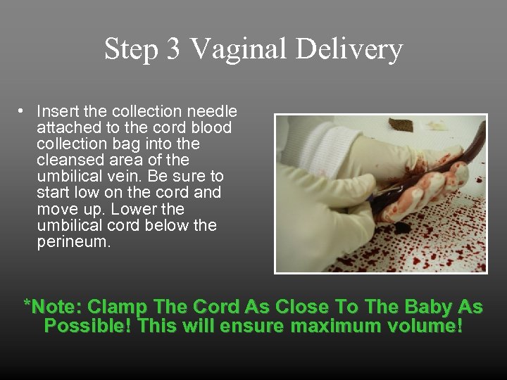Step 3 Vaginal Delivery • Insert the collection needle attached to the cord blood