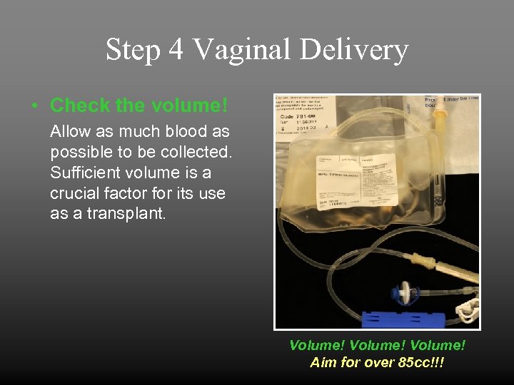 Step 4 Vaginal Delivery • Check the volume! Allow as much blood as possible