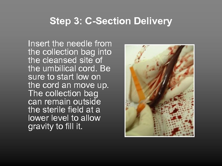 Step 3: C-Section Delivery Insert the needle from the collection bag into the cleansed