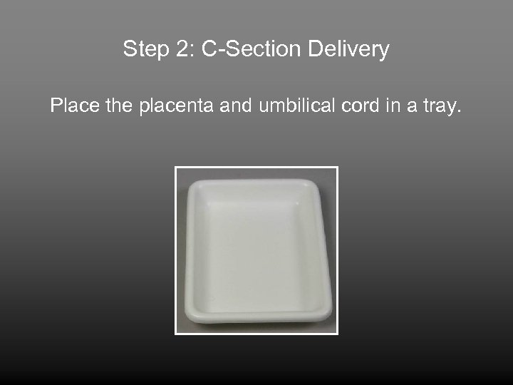 Step 2: C-Section Delivery Place the placenta and umbilical cord in a tray. 