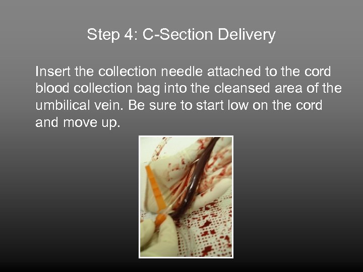 Step 4: C-Section Delivery Insert the collection needle attached to the cord blood collection