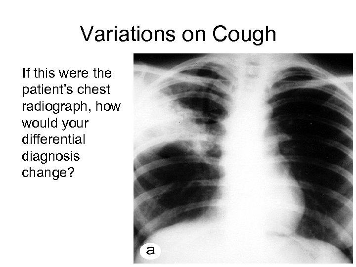 4 What is the diagnosis if this is were his x-ray ? Variations on
