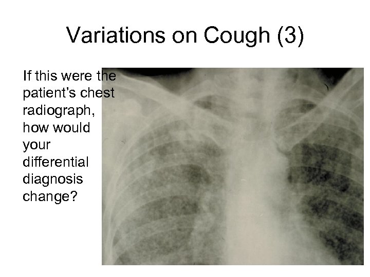 Variations on Cough (3) If this were the patient’s chest radiograph, how would your