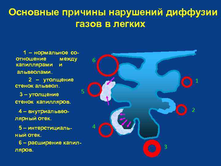 Основные причины нарушений диффузии газов в легких 1 – нормальное соотношение между капиллярами и