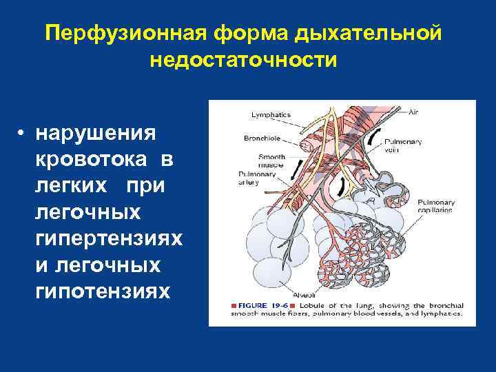 Перфузионная форма дыхательной недостаточности • нарушения кровотока в легких при легочных гипертензиях и легочных