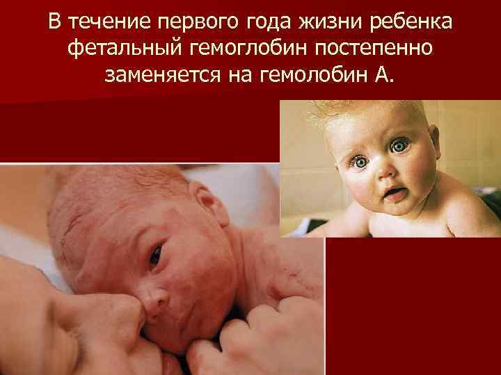 В течение первого года жизни ребенка фетальный гемоглобин постепенно заменяется на гемолобин А. 