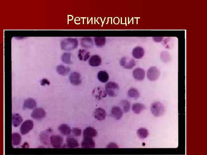 Ретикулоцит 