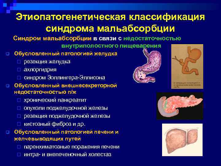 Этиопатогенетическая классификация синдрома мальабсорбции Синдром мальабсорбции в связи с недостаточностью внутриполостного пищеварения q q