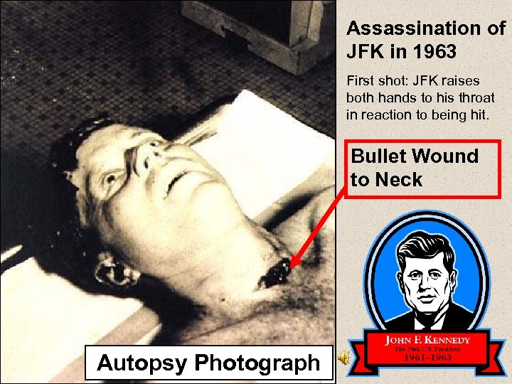 Assassination of JFK in 1963 First shot: JFK raises both hands to his throat