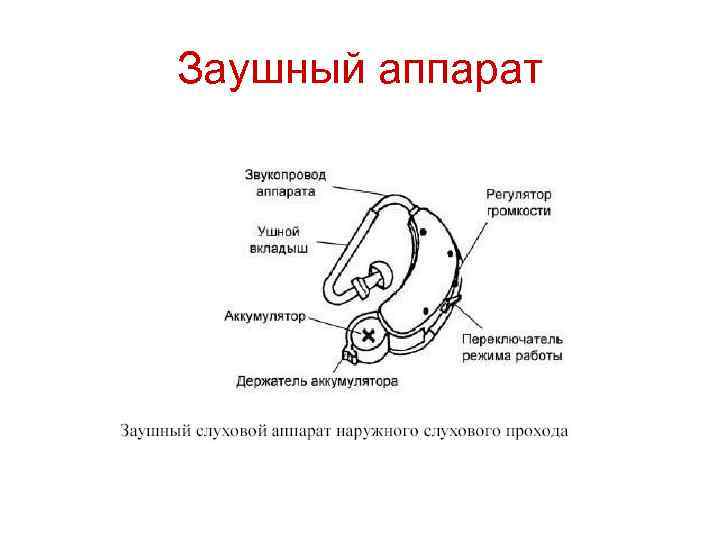 Заушный аппарат 