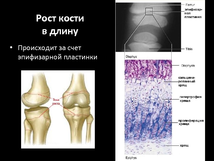 Рост кости в длину • Происходит за счет эпифизарной пластинки 