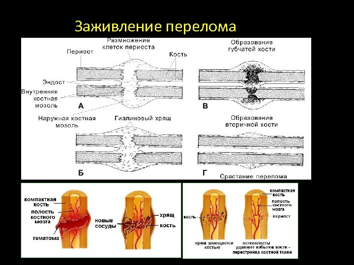 Заживление перелома 