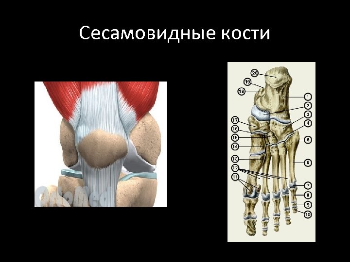 Сесамовидные кости 